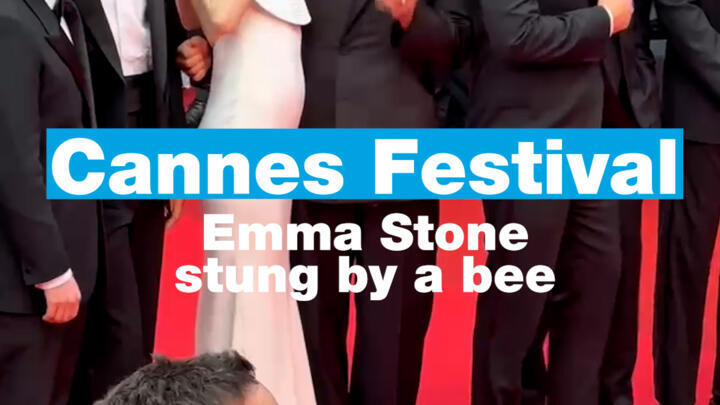 Emma Stone stung by a bee